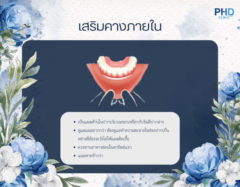 เสริมคางแผลภายใน