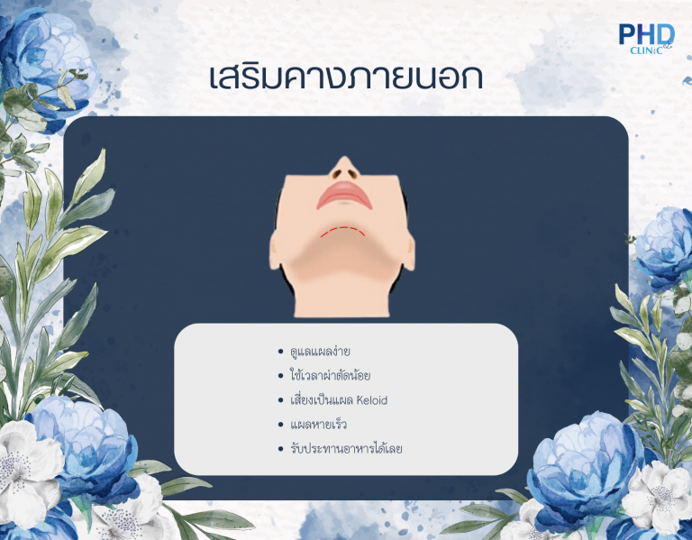 เสริมคางแผลภายนอก