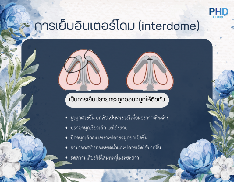 เย็บอินเตอร์โดม