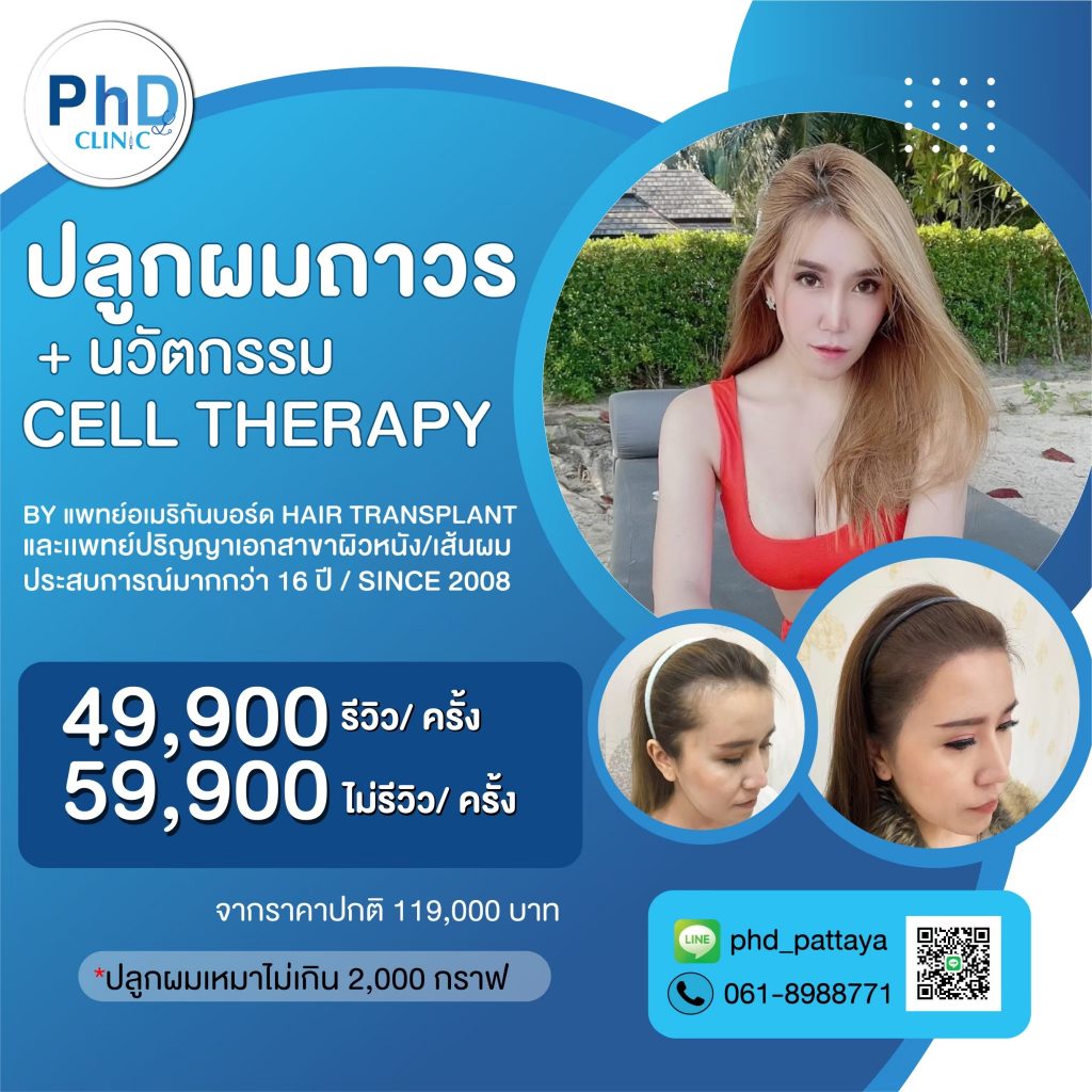โปรโมนชั่น