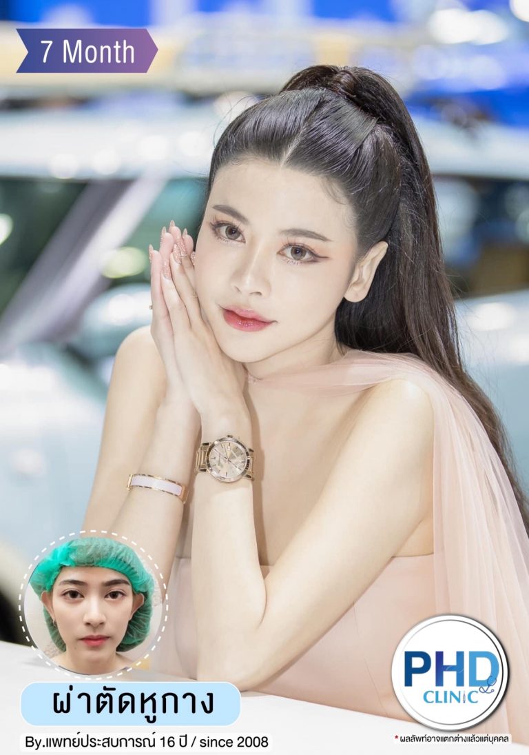 ผ่าตัดหูกาง กรุงเทพ