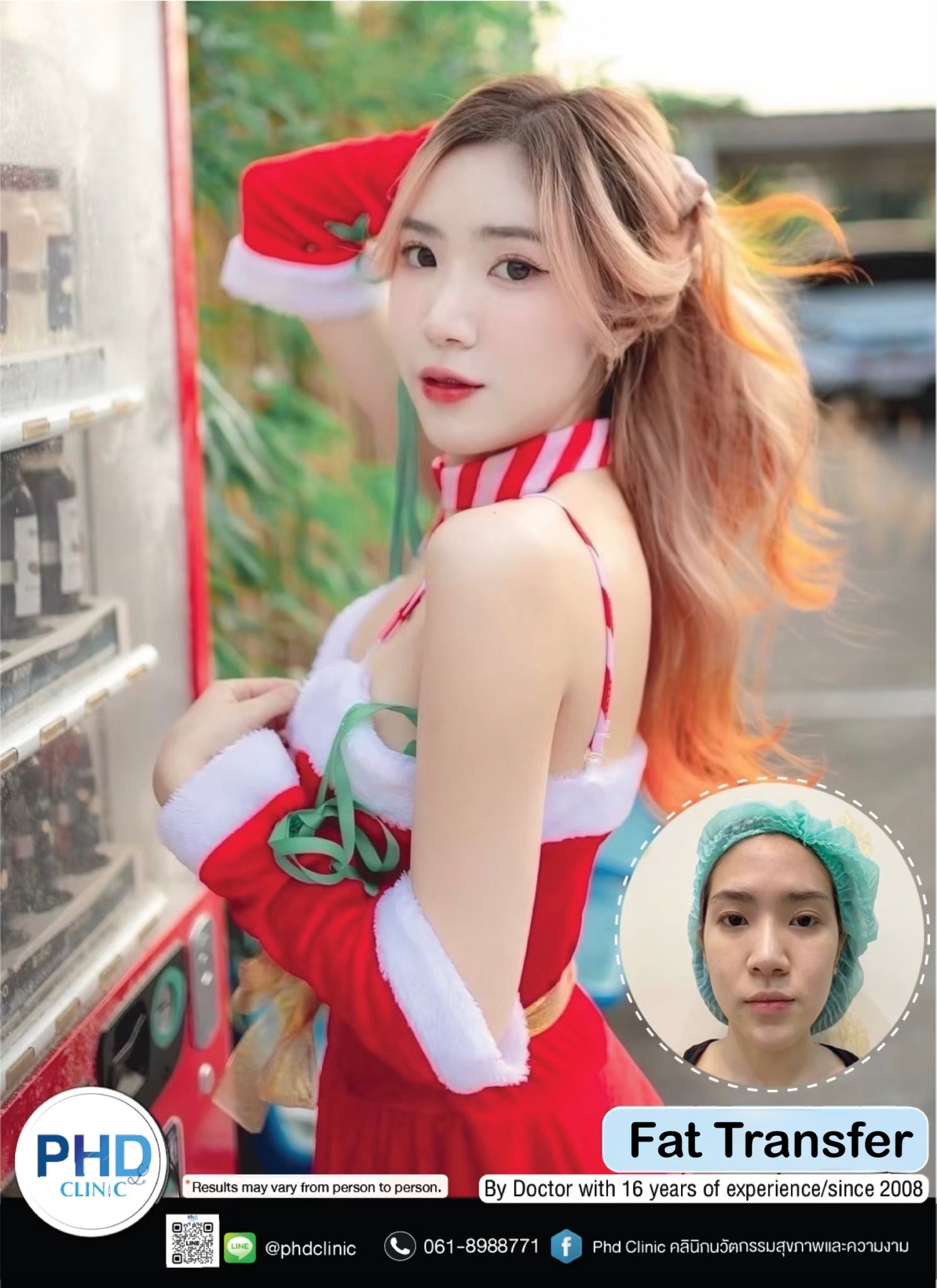 ไขมันหน้า