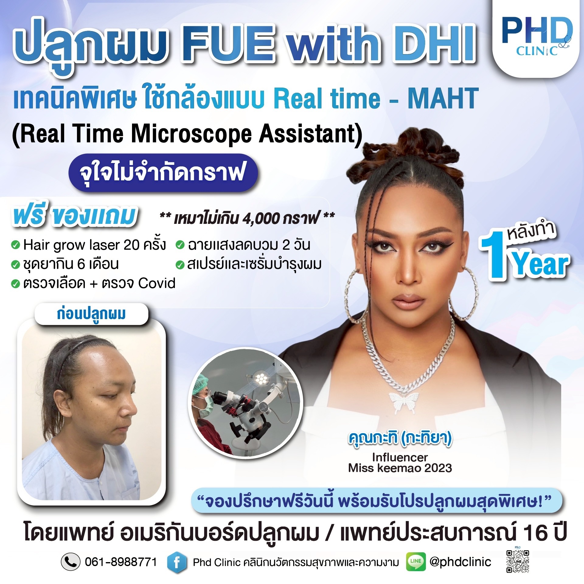 ปลูกผม