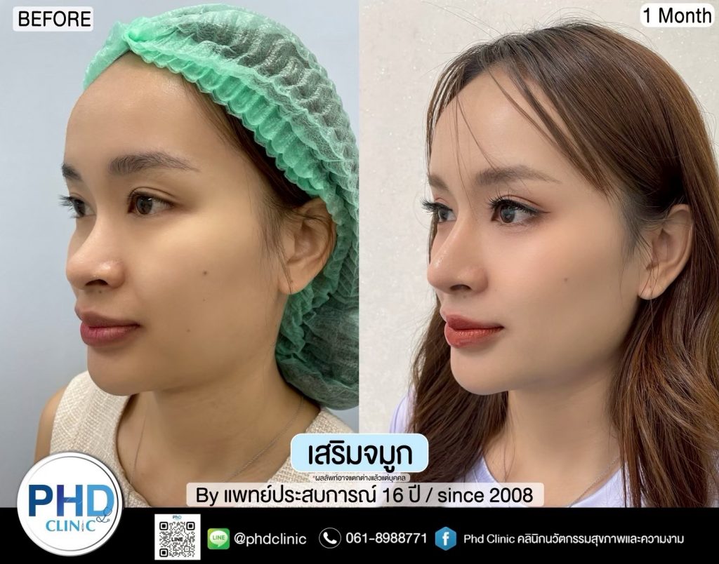 จมูก