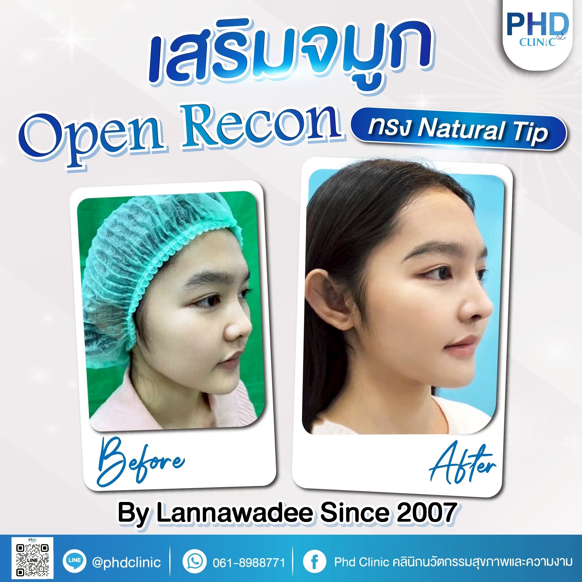 จมูก