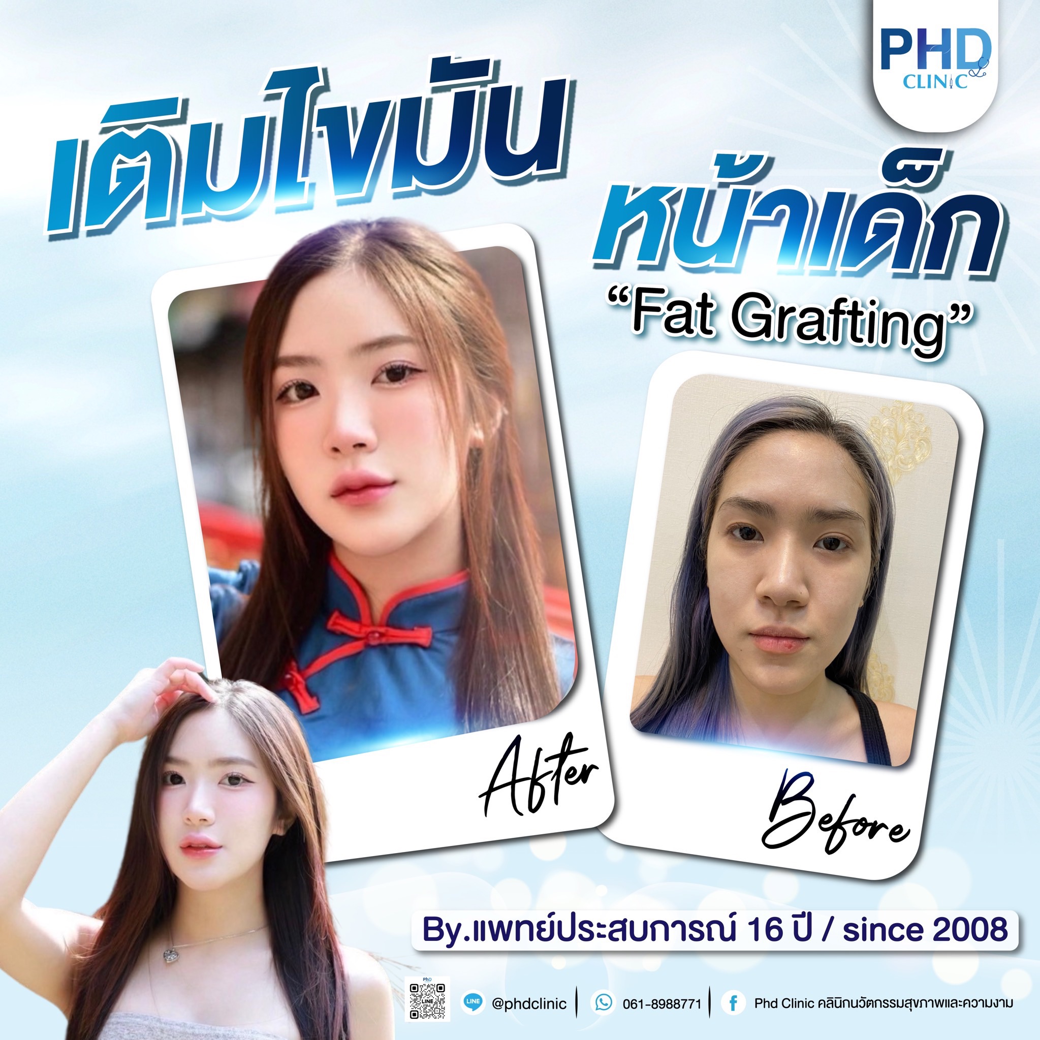 Fat Grafting Phuket