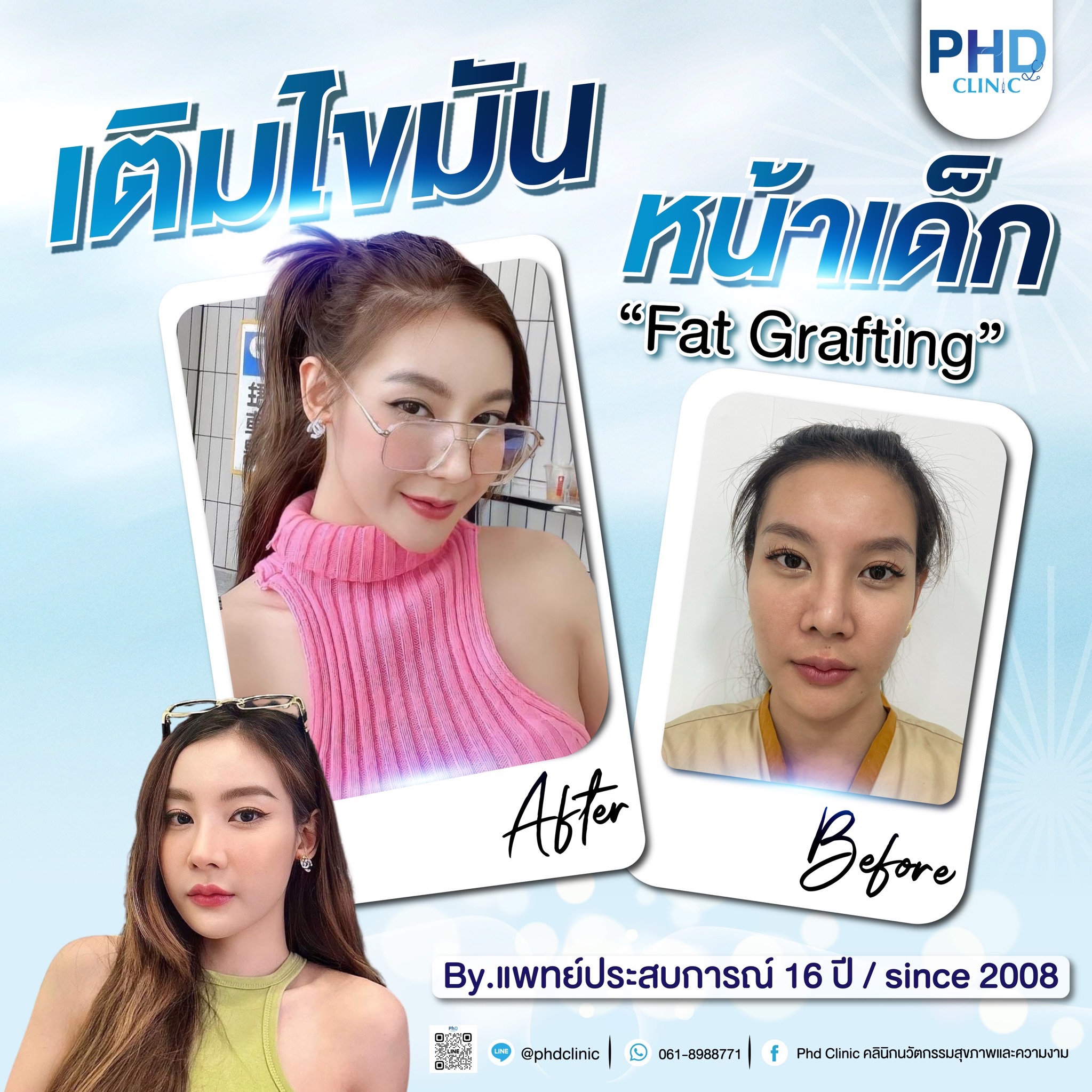 Fat Grafting Phuket