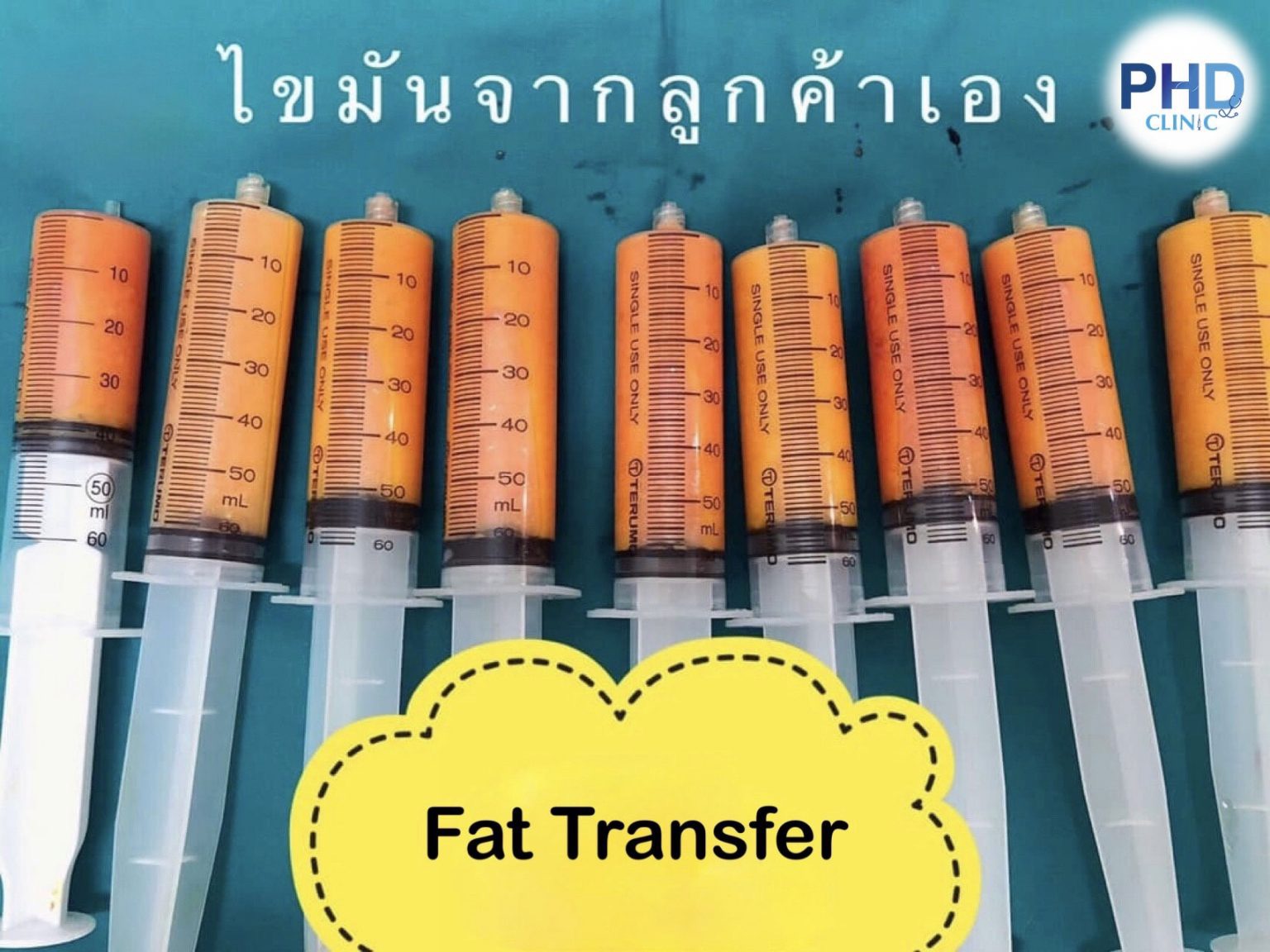 ฉีด fat หน้า