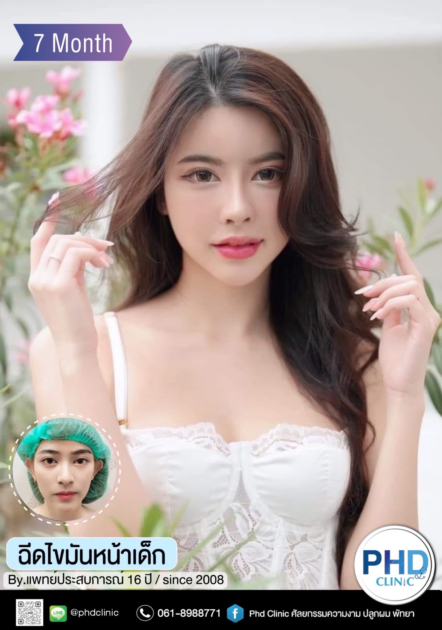 ฉีด fat หน้า