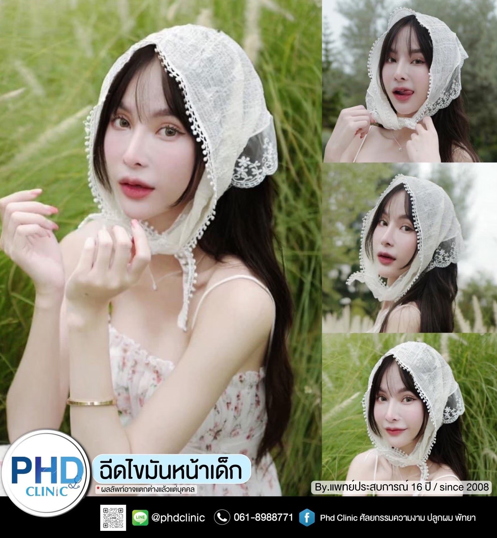 ฉีด fat หน้า