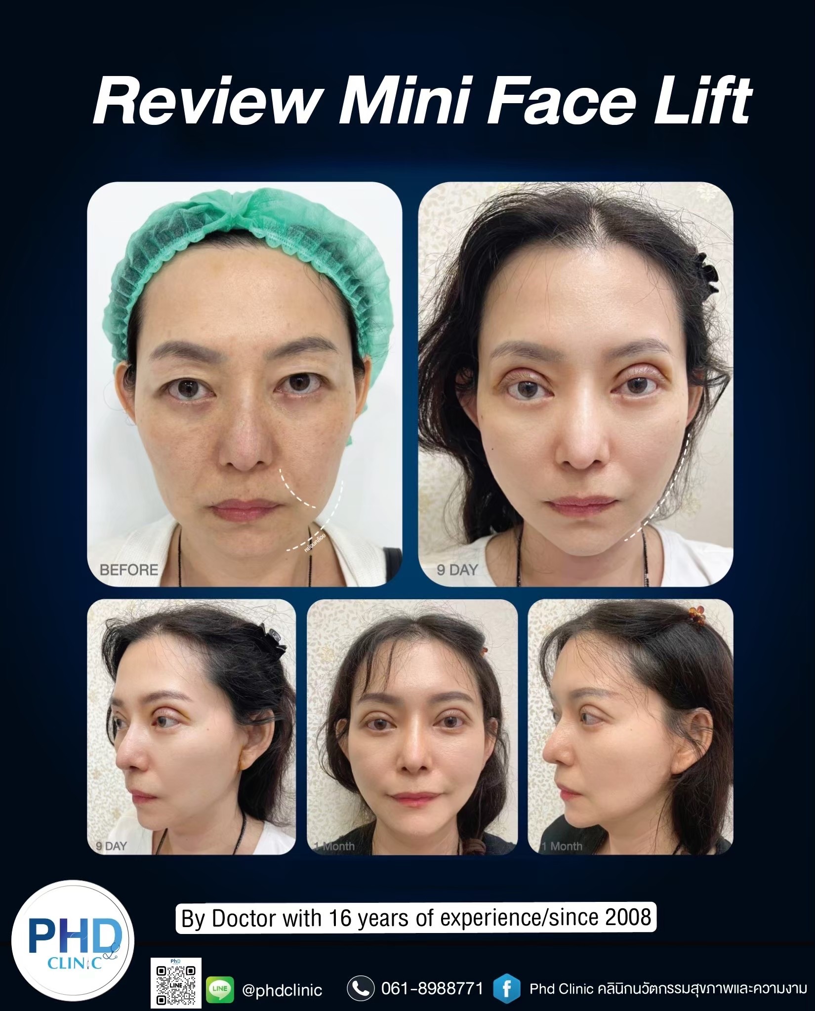 face