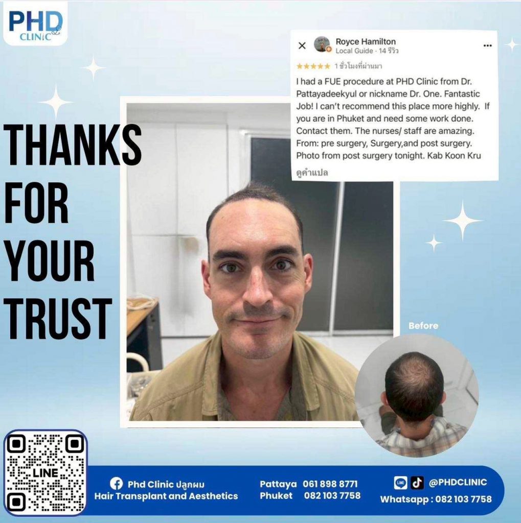 Hair Transplant