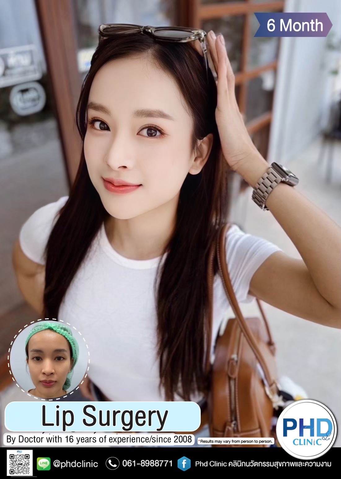 ปากกระจับ