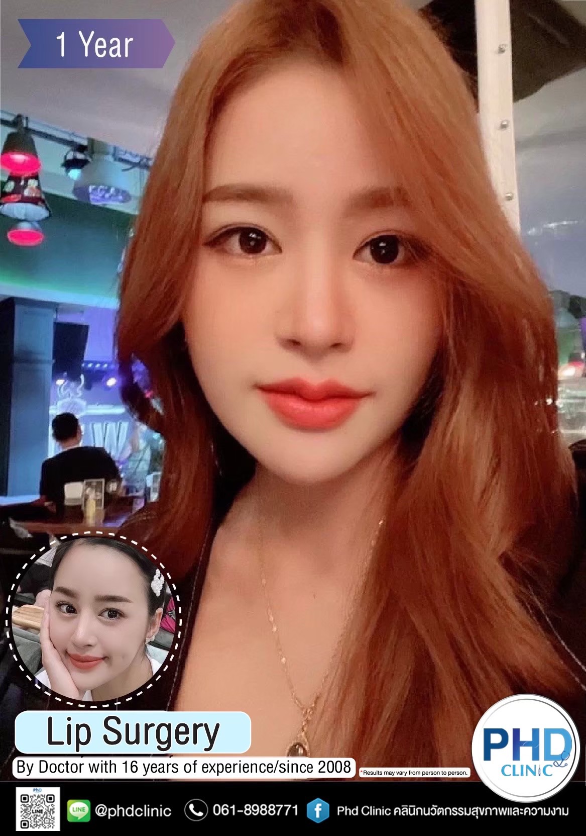 ปากกระจับ