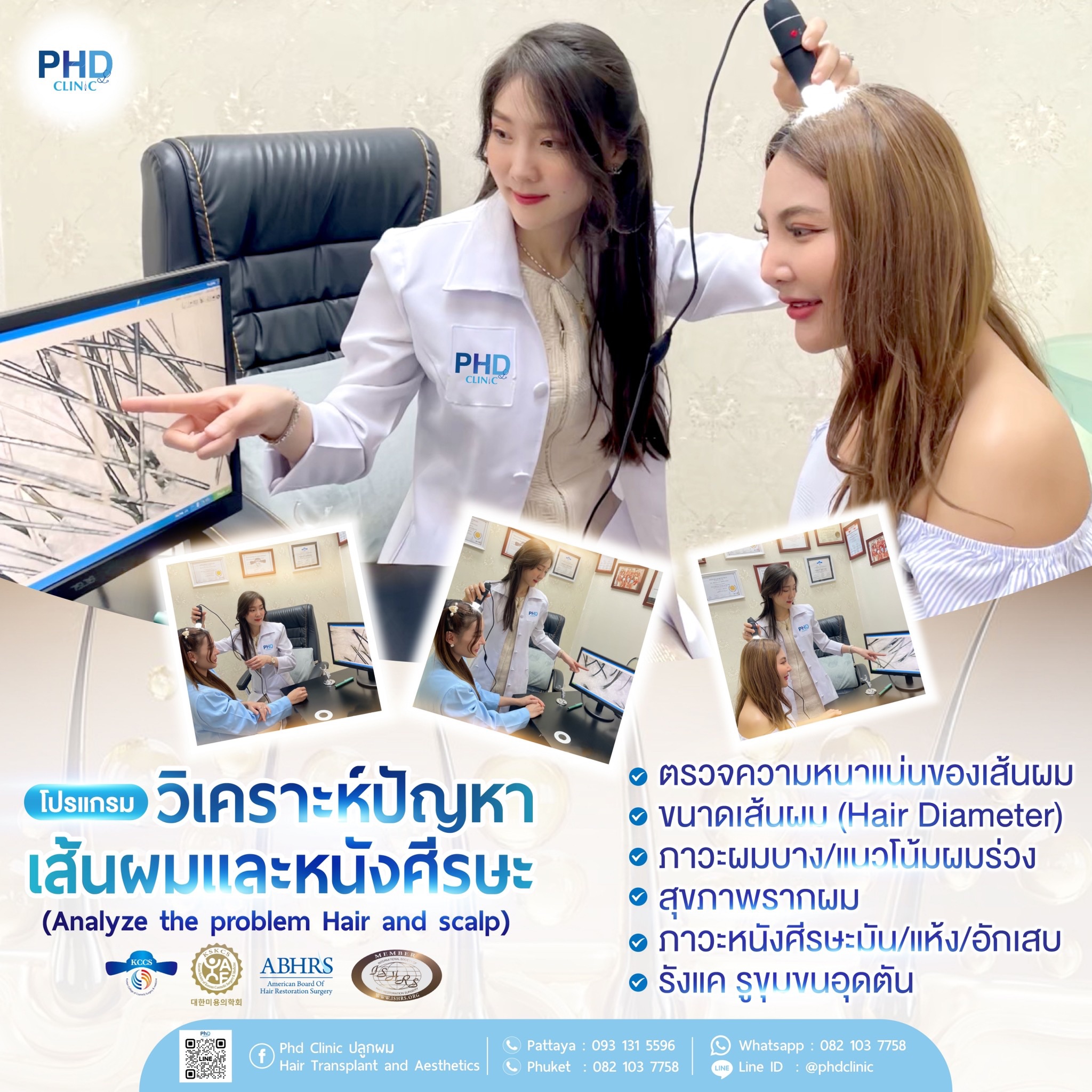 รักษาผมร่วง พัทยา