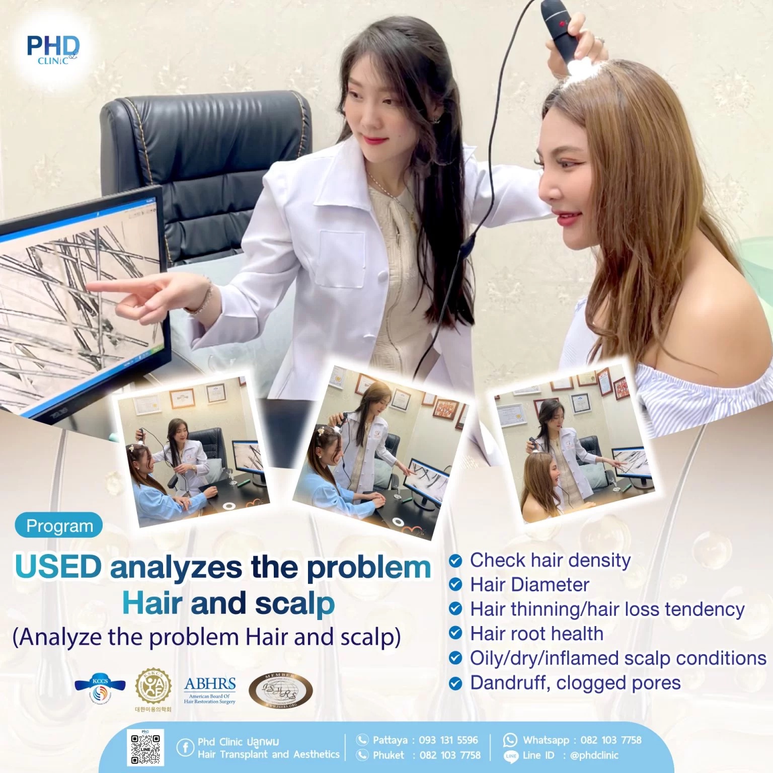 Hair loss clinic Pattaya