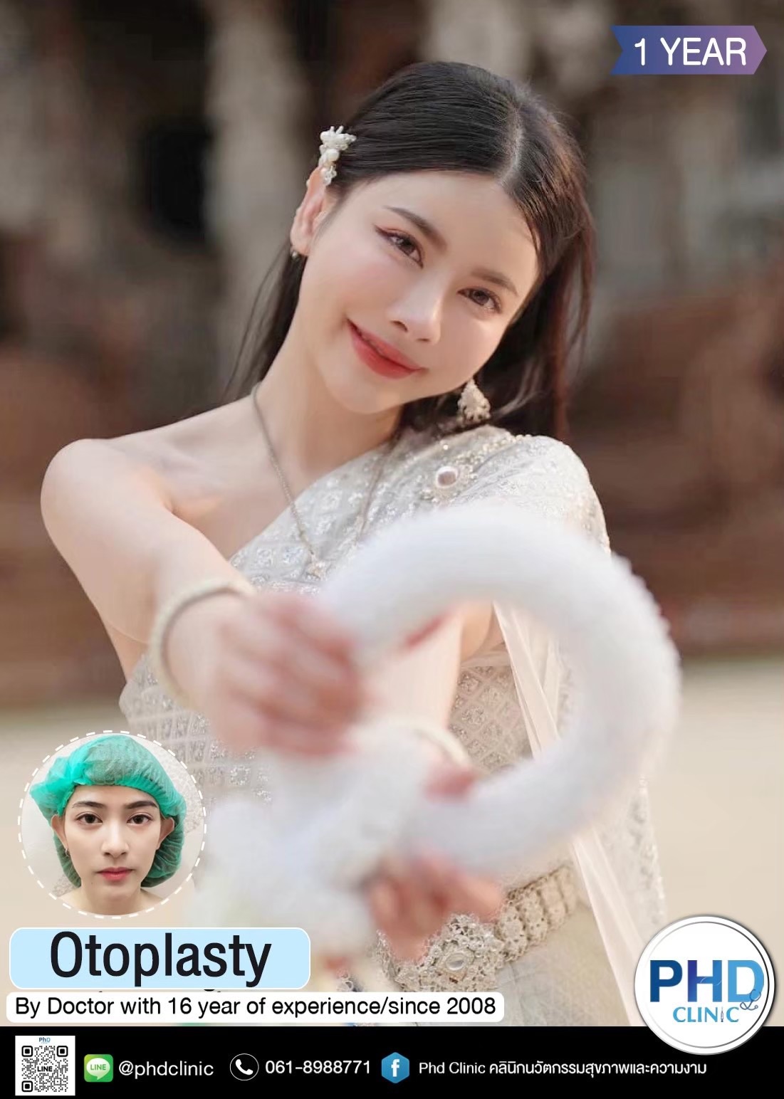 Otoplasty Phuket