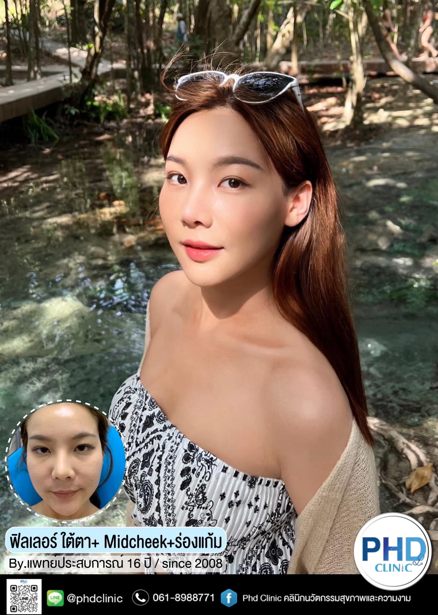 คลินิกปรับรูปหน้า