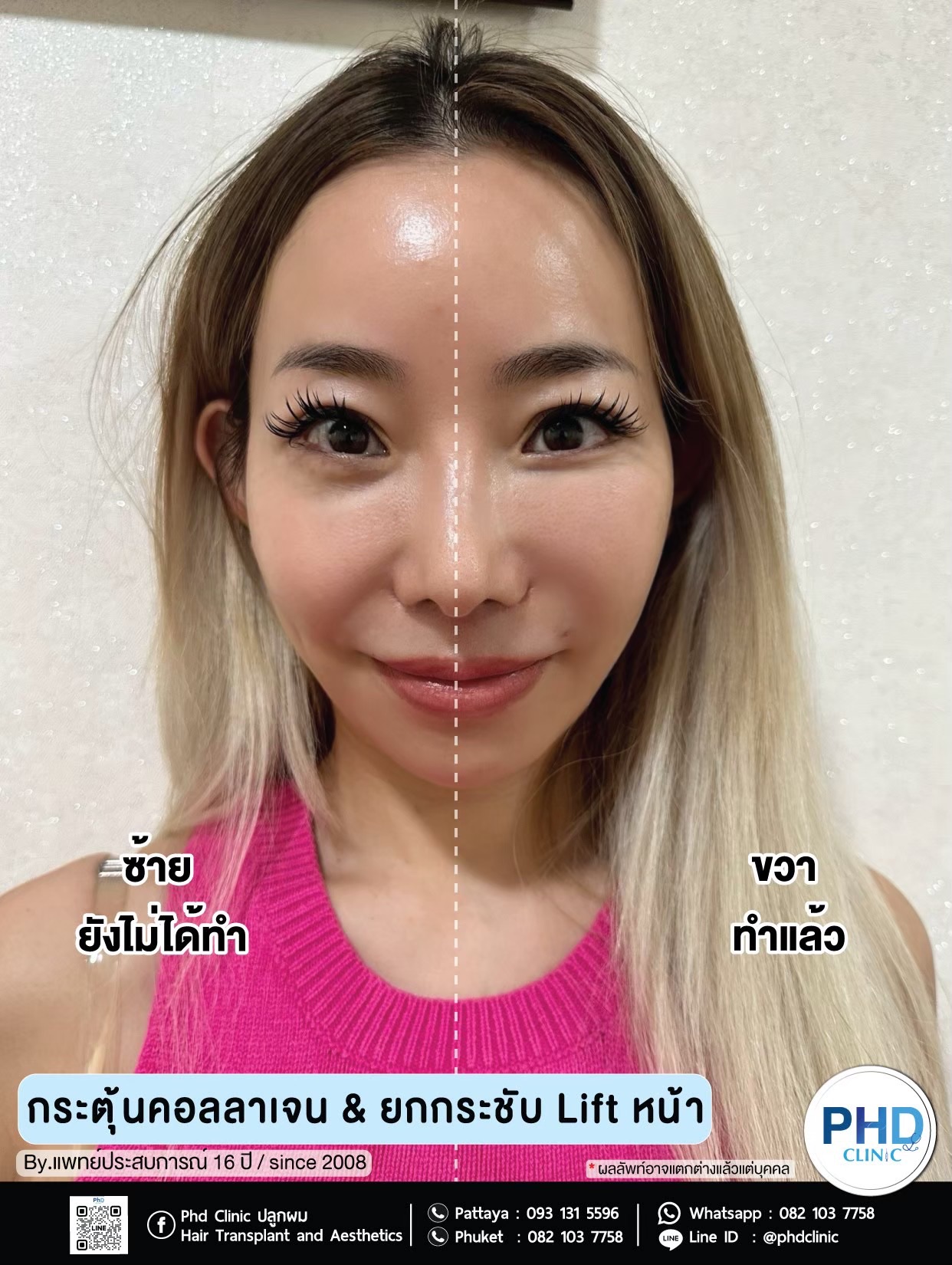 คลินิกปรับรูปหน้า