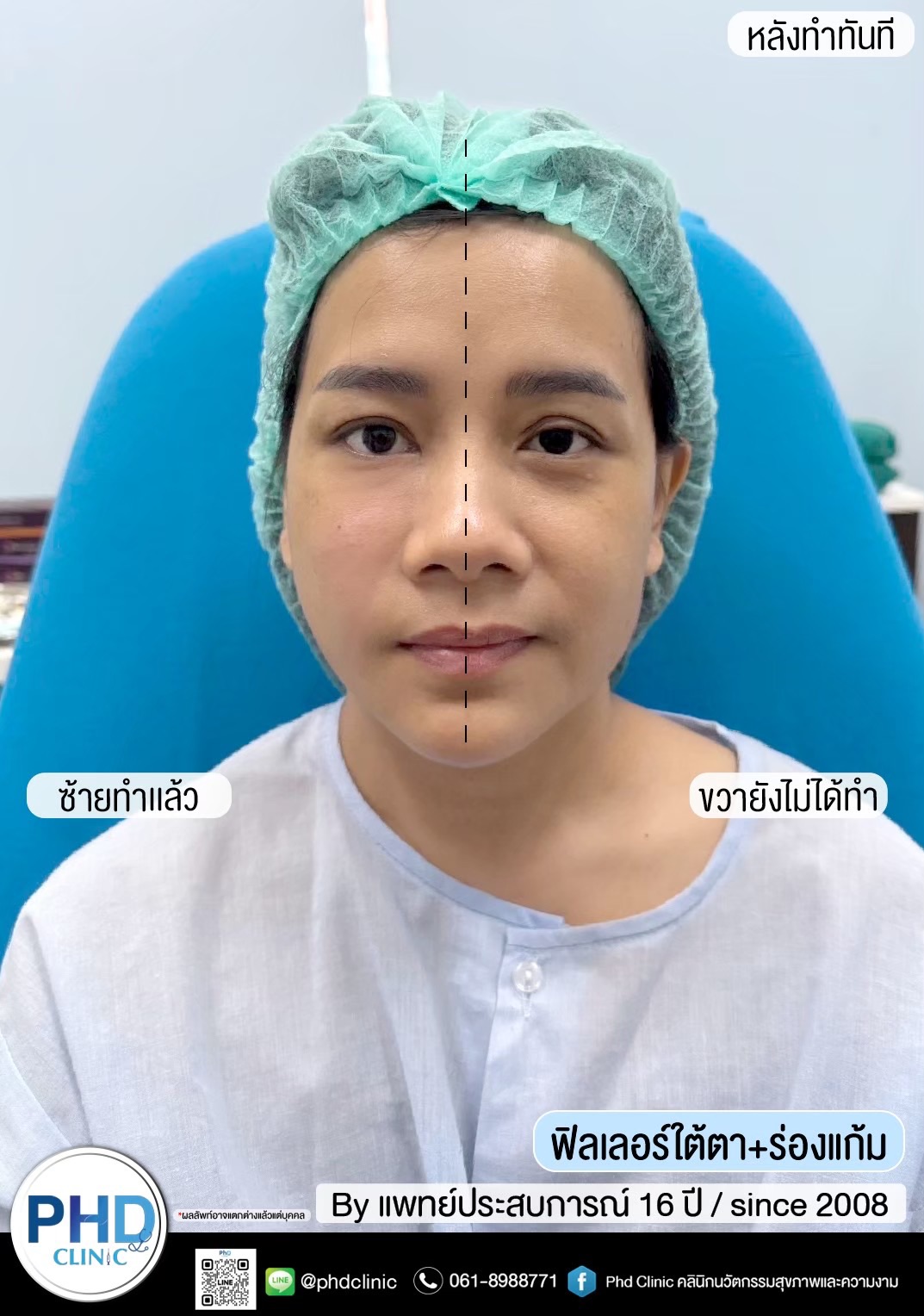 คลินิกปรับรูปหน้า